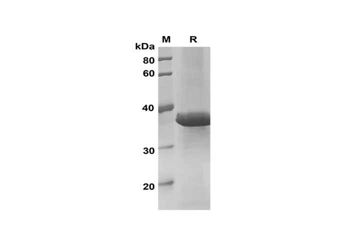 Recombinant Mouse IL-17D Protein(Trx Tag) - image 1