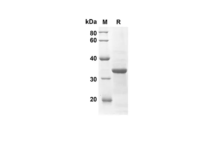 Recombinant Mouse Ccl25 Protein(Sumo Tag) - image 1