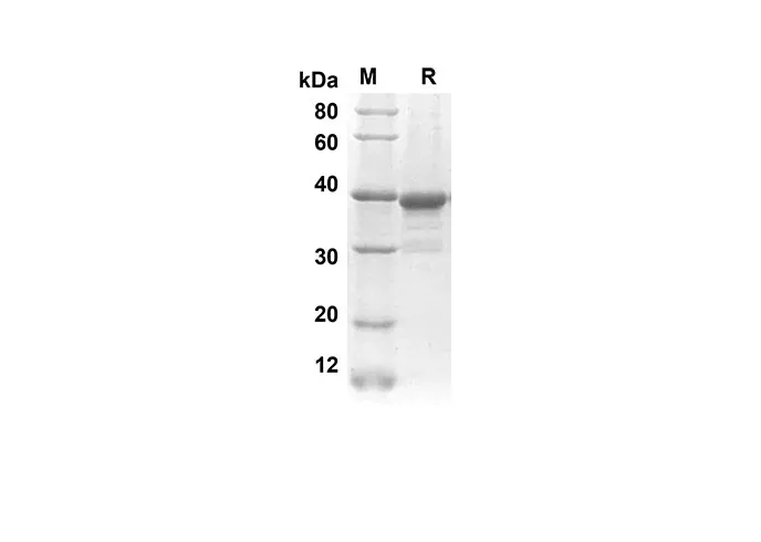 Recombinant Rat CXCL7 Protein(Gst Tag) - image 1