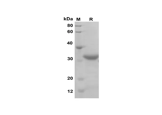Recombinant Mouse PROK1 Protein(Trx Tag) - image 1