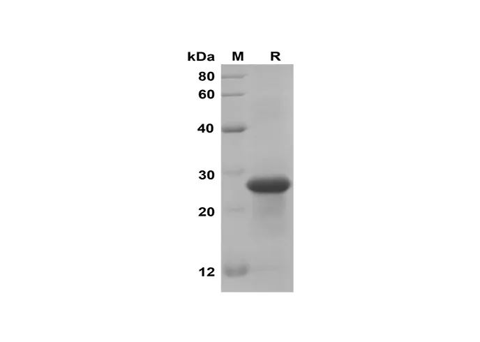 Recombinant Mouse PROK1 Protein(Sumo Tag) - image 1