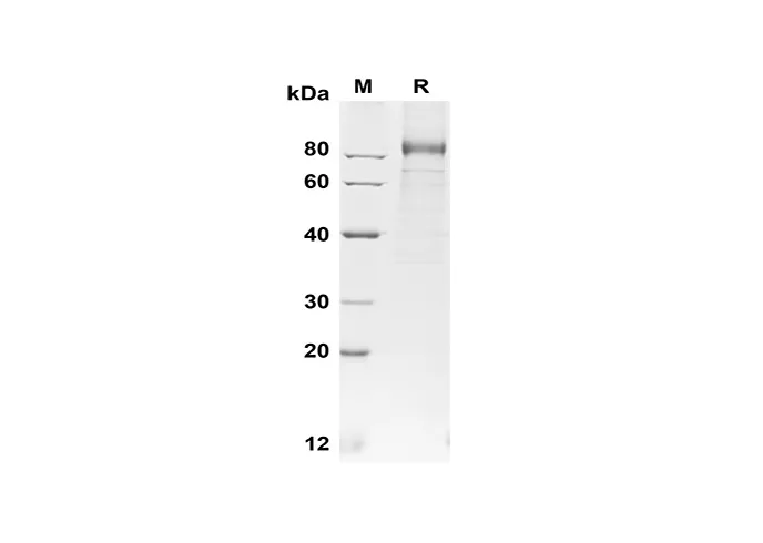 Recombinant Human G-CSF R/CD114 Protein(His Tag) - image 1