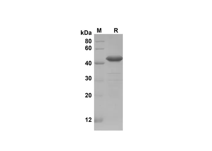 Recombinant Mouse IGFBP-1 Protein(Sumo Tag) - image 1
