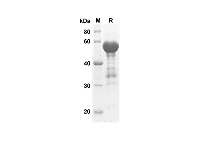 Recombinant Human ACE2 Protein(Trx Tag) - image 1