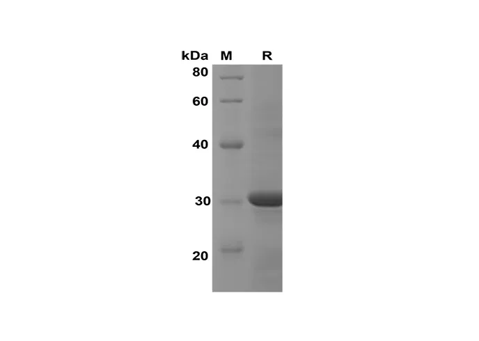 Recombinant Human CCL23/MPIF-1 Protein(Sumo Tag) - image 1