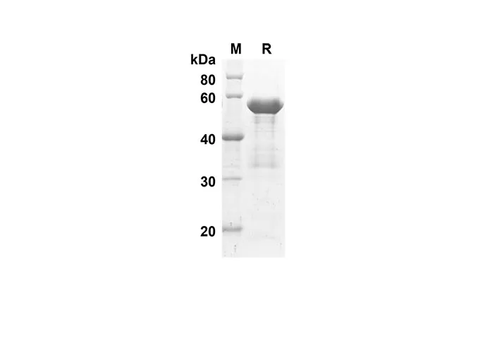 Recombinant Human ACE2 Protein(Sumo Tag) - image 1