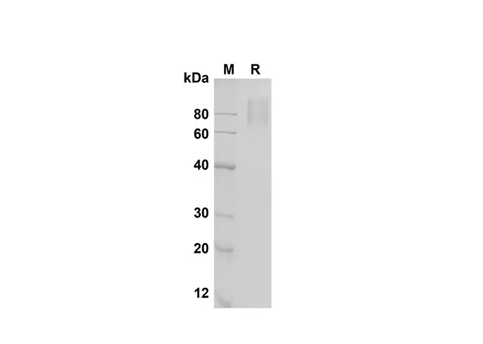 Recombinant Mouse IL-17 RA/IL-17 R Protein(Fc Tag) - image 1