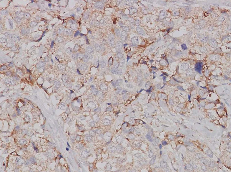 JAK1 Polyclonal Antibody - image 1