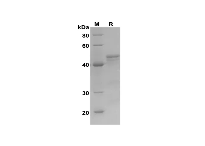 Recombinant Mouse IGFBP-2 Protein(Sumo Tag) - image 1