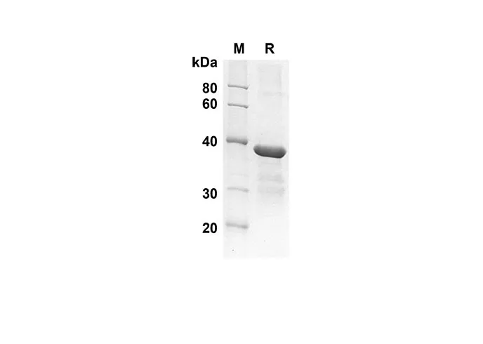 Recombinant Human GROβ/CXCL2 Protein(Gst Tag) - image 1