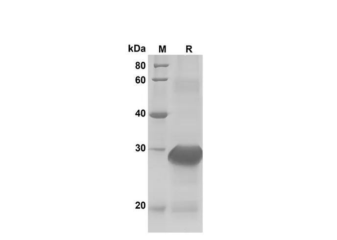 Recombinant Rat CCL2/JE/MCP-1 Protein(Trx Tag) - image 1