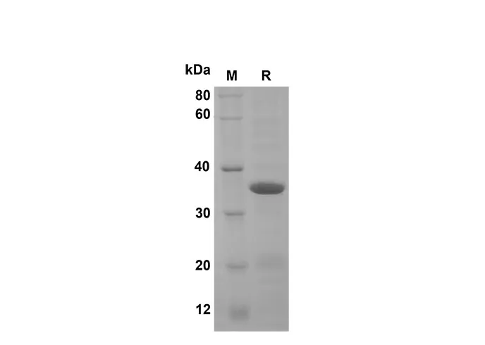 Recombinant Mouse Lymphotoxin-α/TNF-β Protein(Sumo Tag) - image 1