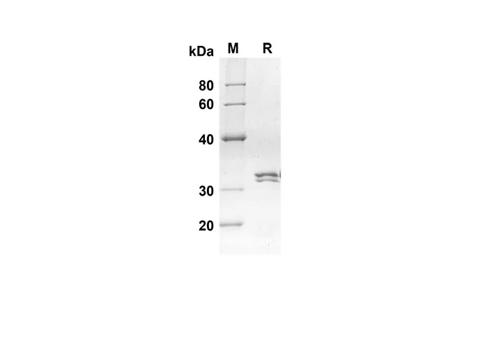 Recombinant Mouse Ccl24 Protein(Trx Tag) - image 1