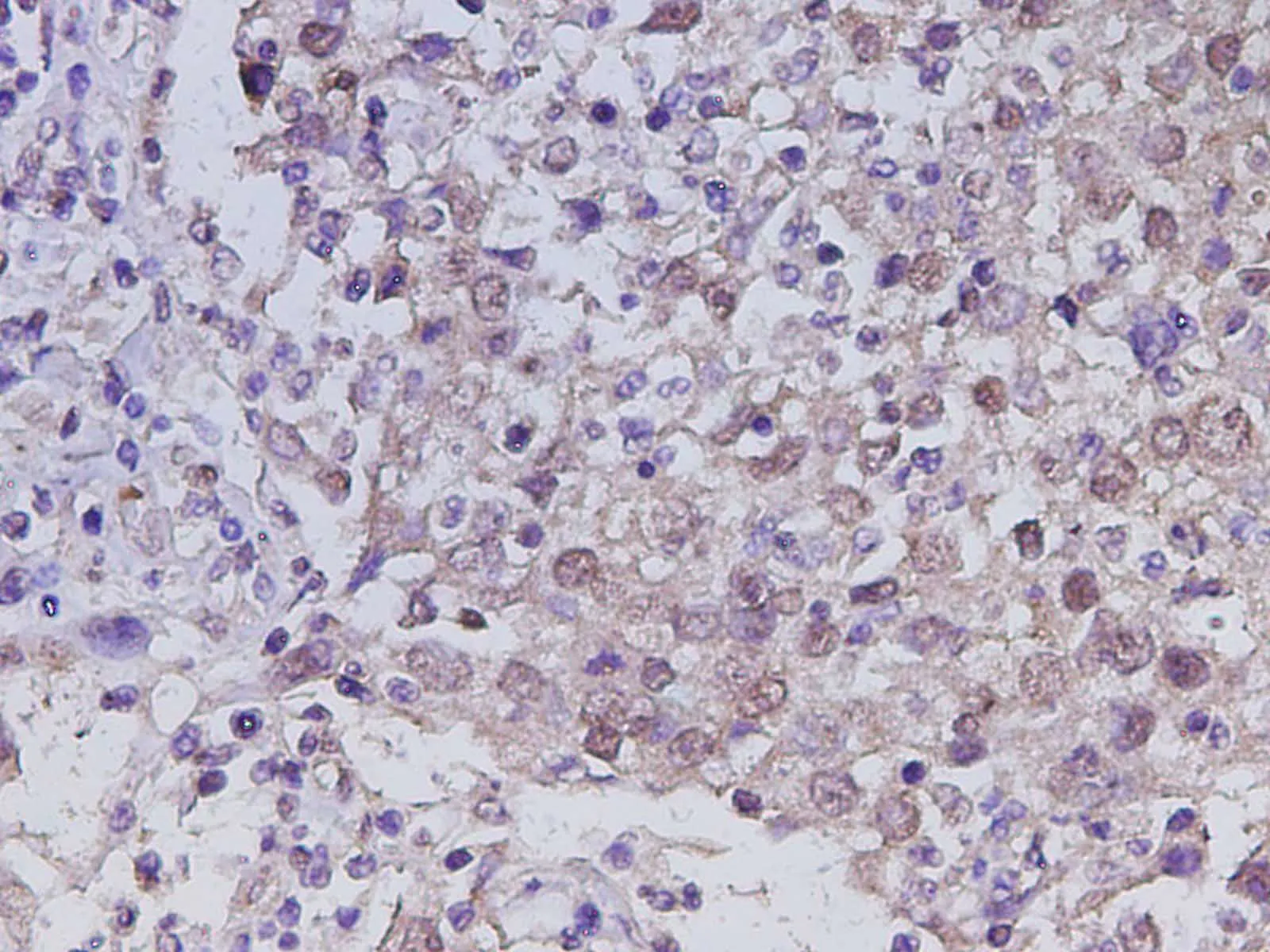 RUNX2 Polyclonal Antibody - image 1