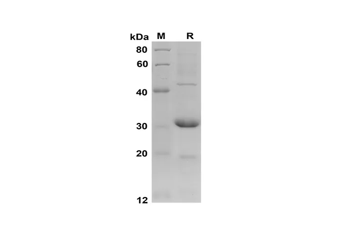 Recombinant Mouse CCL2/JE/MCP-1 Protein(Trx Tag) - image 1