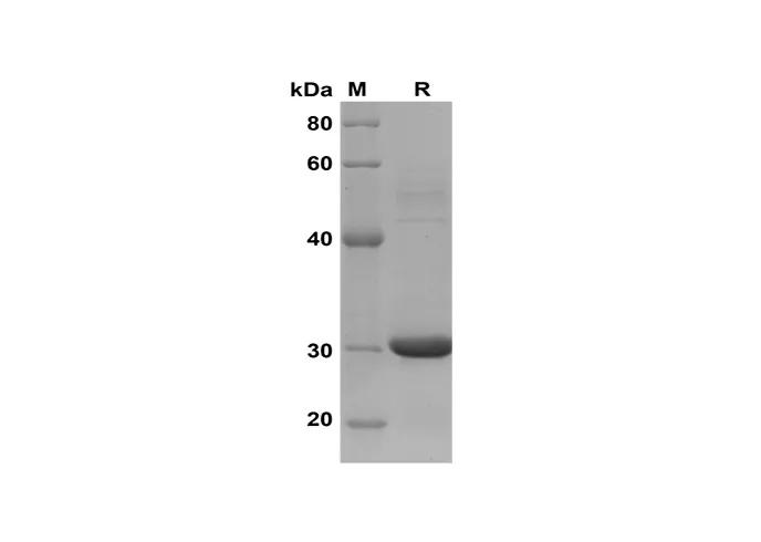 Recombinant Human CCL18/PARC Protein(Trx Tag) - image 1