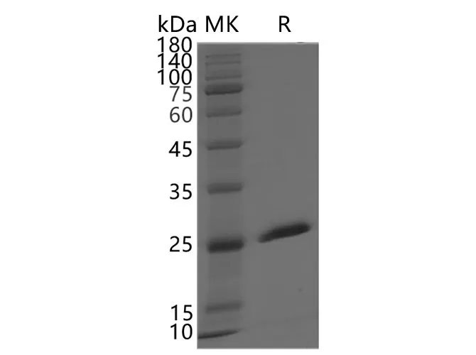 Recombinant SARS-CoV-2 NSP3 protein - image 1