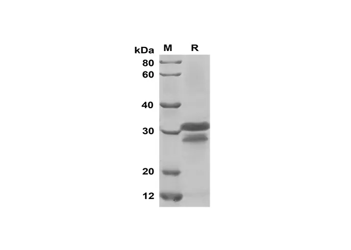 Recombinant Mouse CCL3/MIP-1α Protein(Trx Tag) - image 1