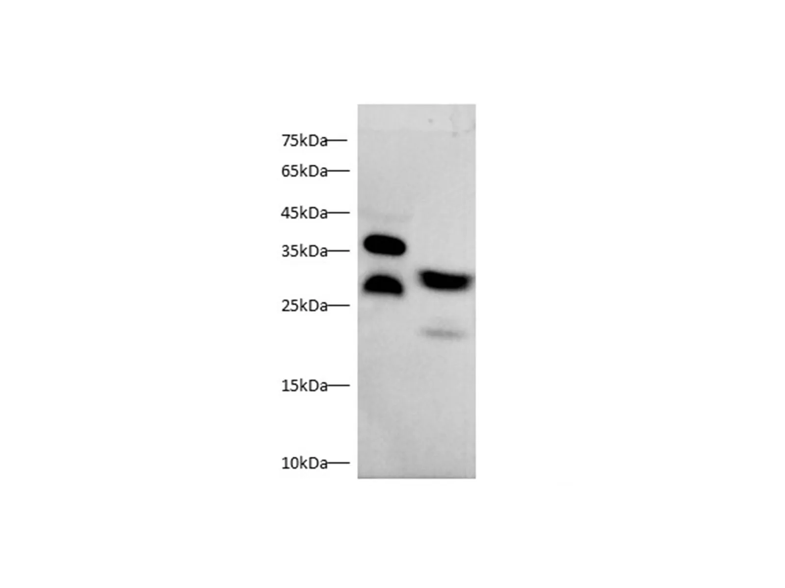 MBL2/MBP-C Polyclonal Antibody - image 1