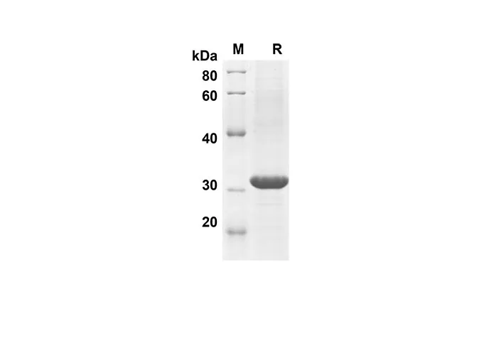 Recombinant Mouse CCL11 Protein(Trx Tag) - image 1