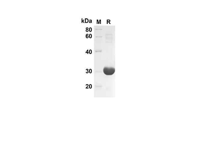 Recombinant Mouse CXCL2 Protein(Trx Tag) - image 1
