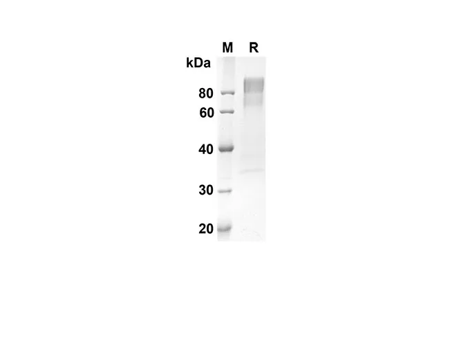 Recombinant Human CD30 Protein(Fc Tag) - image 1