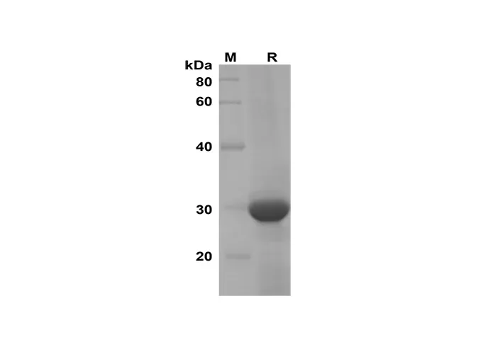 Recombinant Mouse CXCL7 Protein(Trx Tag) - image 1