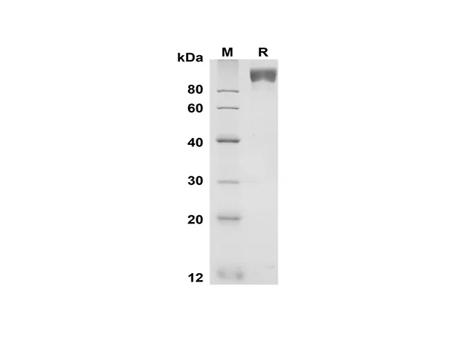 Recombinant Mouse gp130 Protein(Fc Tag) - image 1