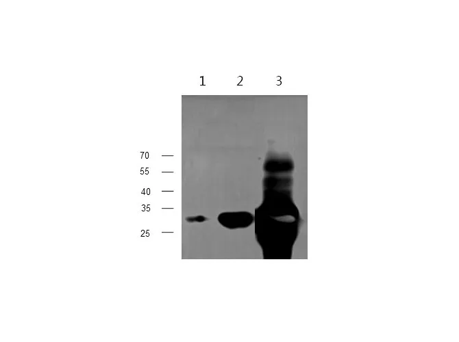 TNNI3/cTn-I Polyclonal Antibody - image 1