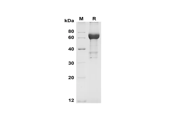 Recombinant Human SEPP1 Protein(Fc Tag) - image 1