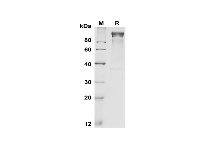 Recombinant Mouse G-CSF R/CD114 Protein(Fc Tag) - image 1
