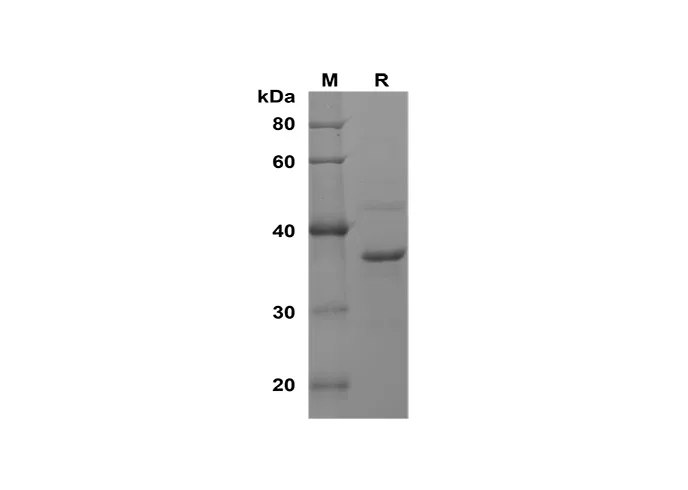 Recombinant Mouse SYN1 Protein(Sumo Tag) - image 1