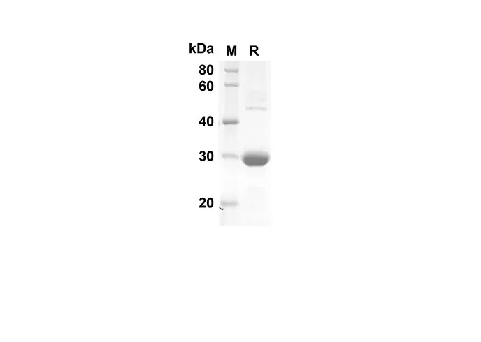 Recombinant Human CXCL5 Protein(Trx Tag) - image 1