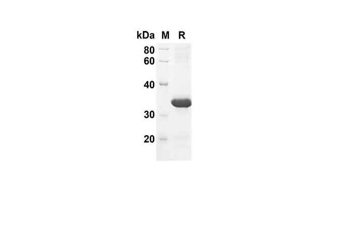Recombinant Mouse Ccl21a Protein(Trx Tag) - image 1