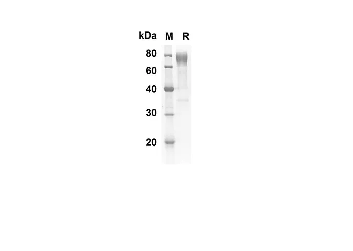 Recombinant Mouse CD30 Protein(Fc Tag) - image 1
