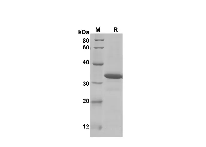 Recombinant Mouse CCL9/10/MIP-1γ Protein(Trx Tag) - image 1