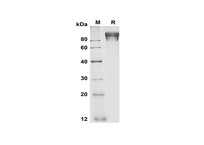 Recombinant Human G-CSF R/CD114 Protein(Fc Tag) - image 1