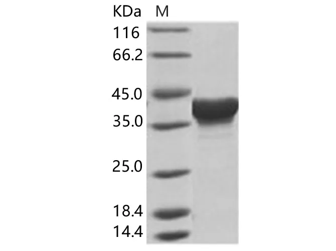 Recombinant EBOV (subtype Zaire, strain H.sapiens-wt/GIN/2014/Kissidougou-C15) Matrix protein VP40 Protein (His Tag) - image 1