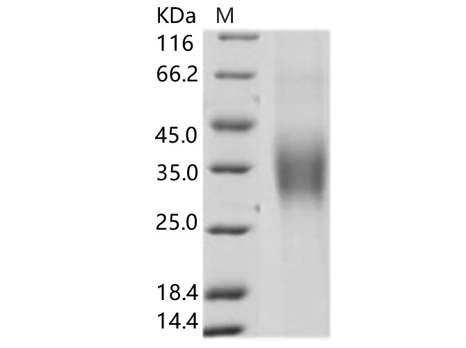 Recombinant HCV Envelope Glycoprotein E1 / HCV-E1 (subtype 1b, strain HC-J4) Protein (His Tag) - image 2