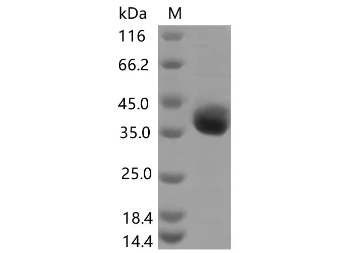 Recombinant SARS-CoV-2 Spike RBD (E406Q) (His Tag) - image 2