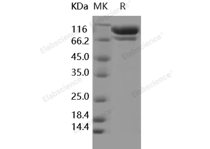 Recombinant Human C2/Complement Component 2 Protein (His Tag) - image 2