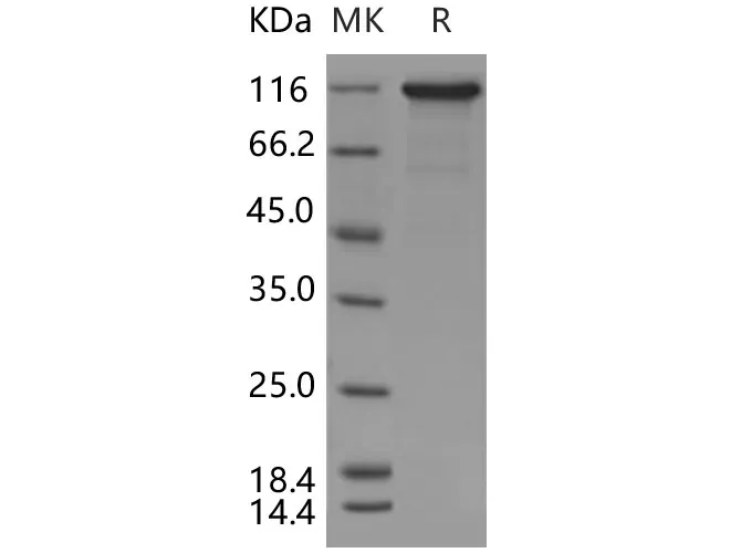 Recombinant Human C6/complement component 6 Protein (His Tag) - image 2