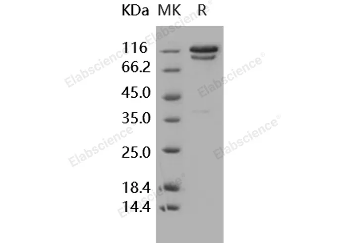 Recombinant Human C2/Complement Component 2 Protein (Fc Tag) - image 2