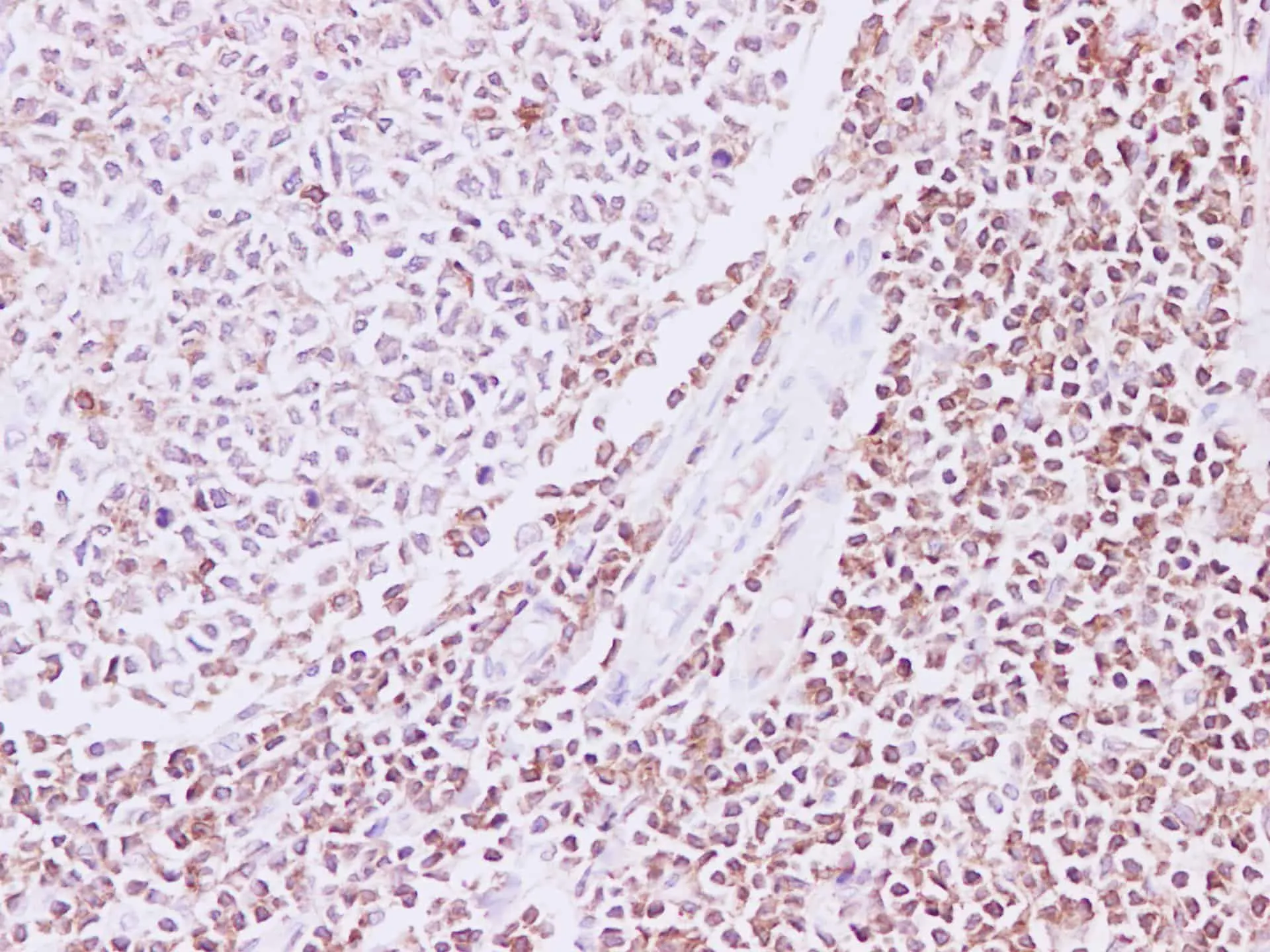 RAC2 Polyclonal Antibody - image 1