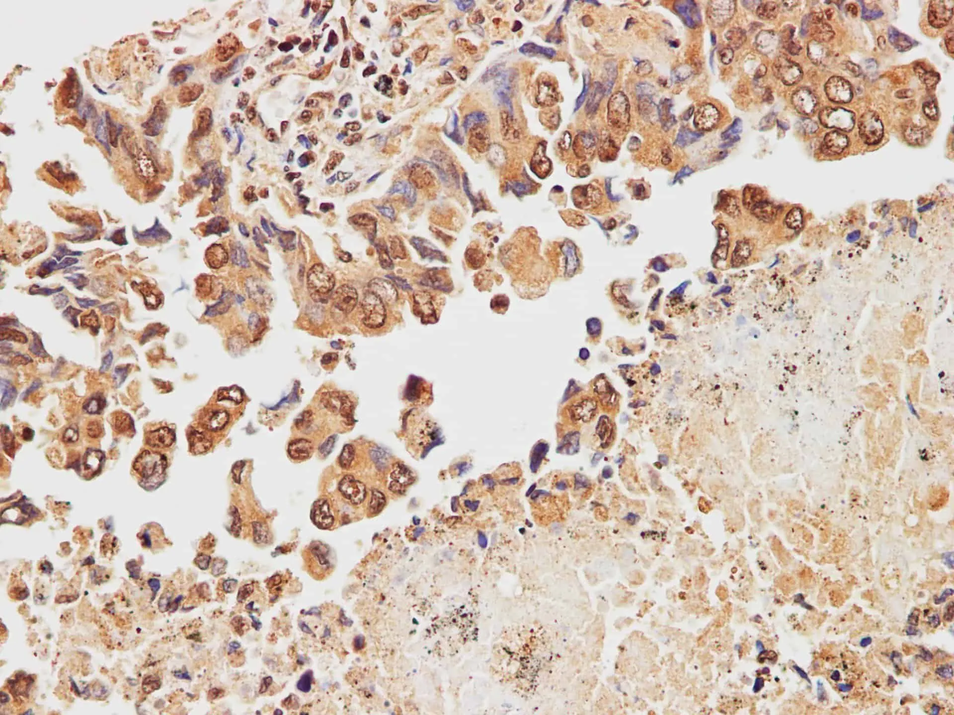 STOML2 Polyclonal Antibody - image 1