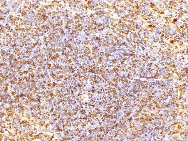 CD38 Polyclonal Antibody - image 2
