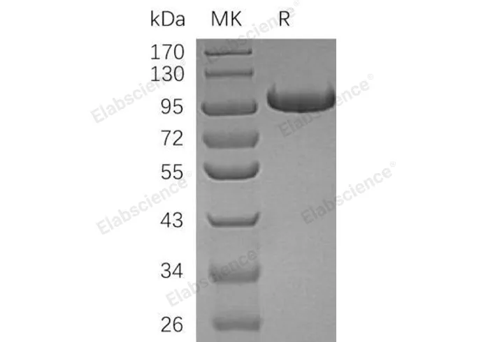 Recombinant Human Complement Factor B/CFB Protein (His Tag) - image 2
