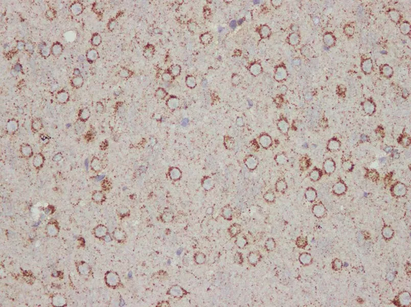 PSAP Polyclonal Antibody - image 2
