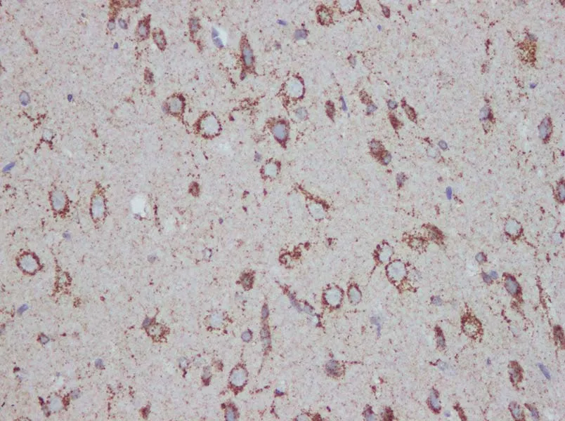 PSAP Polyclonal Antibody - image 3