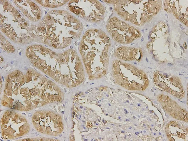 GSTA1 Polyclonal Antibody - image 2